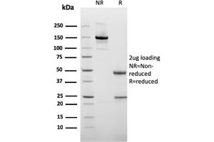SDS-PAGE Analysis of Purified Cytokeratin 10 Mouse Recombinant Monoclonal Antibody (rKRT10/1275). (Recombinant Keratin 10 anticorps)