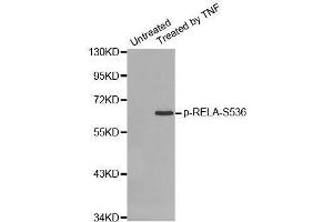 Western blot analysis of extracts from HepG2 cells using Phospho-RELA-S536 antibody (ABIN2987368). (NF-kB p65 anticorps  (pSer536))