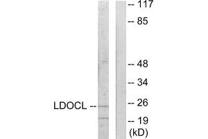 Western blot analysis of extracts from COLO205 cells, using LDOCL antibody. (LDOC1L anticorps  (Internal Region))
