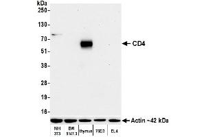 Western Blotting (WB) image for anti-CD4 (CD4) (AA 407-457) antibody (ABIN7453902)