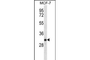 TESSP1 Antibody (Center) (ABIN656462 and ABIN2845746) western blot analysis in MCF-7 cell line lysates (35 μg/lane). (TESSP1 anticorps  (AA 106-133))