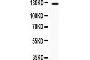 Western blot analysis of AFF44 expression in COLO320 whole cell lysates ( Lane 1). (AFF4 anticorps  (N-Term))