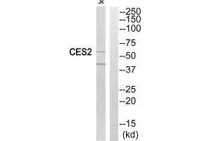 Western Blotting (WB) image for anti-Carboxylesterase 2 (CES2) (Internal Region) antibody (ABIN1851018) (CES2 anticorps  (Internal Region))