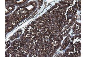 Image no. 4 for anti-Armadillo Repeat Containing 1 (ARMC1) antibody (ABIN1496724) (ARMC1 anticorps)