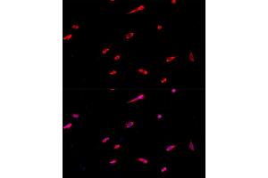 anti-Eukaryotic Translation Initiation Factor 3 Subunit J (EIF3S1) (AA 1-258) antibody