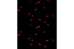 Immunofluorescence analysis of PC-12 cells using EIF3J antibody (ABIN6127835, ABIN6140070, ABIN6140071 and ABIN6224734) at dilution of 1:100. (EIF3S1 anticorps  (AA 1-258))
