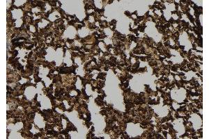ABIN6272400 at 1/100 staining Mouse lung tissue by IHC-P. (POTE-14/22 anticorps)