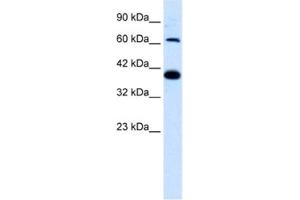 Western Blotting (WB) image for anti-Glutamate Receptor, Ionotropic, Kainate 2 (GRIK2) antibody (ABIN2461162) (GRIK2 anticorps)