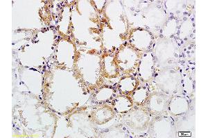 Formalin-fixed and paraffin embedded human kidney tissue labeled with Anti CD30/TNFRSF8/CD153 Polyclonal Antibody, Unconjugated (ABIN741090) at 1:200 followed by conjugation to the secondary antibody and DAB staining