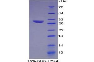 SDS-PAGE analysis of Rat Hydroxyacid Oxidase 1 Protein. (HAO1 Protéine)