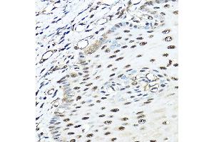 Immunohistochemistry of paraffin-embedded human esophageal using VCP Rabbit pAb (ABIN3016711, ABIN3016712, ABIN3016713 and ABIN6219823) at dilution of 1:100 (40x lens). (VCP anticorps)