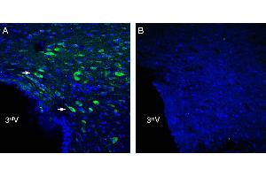 Expression of /LRRC4 in rat hypothalamus.