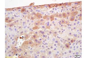 Formalin-fixed and paraffin embedded mouse liver labeled with Rabbit Anti Adiponectin Polyclonal Antibody, Unconjugated (ABIN669051) at 1:200 followed by conjugation to the secondary antibody and DAB staining (ADIPOQ anticorps  (AA 151-244))