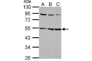 WB Image Sample (30 ug of whole cell lysate) A: 293T B: A431 C: HepG2 10% SDS PAGE antibody diluted at 1:5000 (GLRa2 anticorps)
