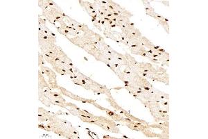Immunohistochemistry of paraffin embedded rat heart using smad62024 (ABIN7075629) at dilution of 1:1000 (400x lens)