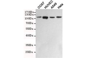 Western blot testing of monkey COS7, human HUVEC, human A549 and human HeLa cell lysates with FAK antibody at 1:1000.