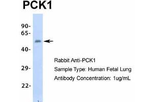 Host: Rabbit  Target Name: PCK1  Sample Tissue: Human Fetal Lung  Antibody Dilution: 1. (PCK1 anticorps  (Middle Region))