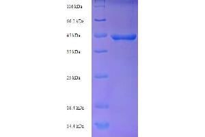 Recoverin (RCVRN) (AA 1-242), (full length) protein (His-SUMO Tag)