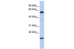 WB Suggested Anti-TRIAntibody Titration:  0. (TRIP10 anticorps  (Middle Region))