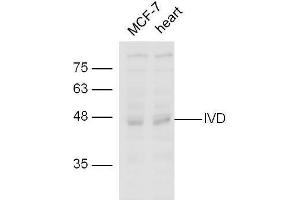 line1,MCF-7 lysates；line2,mouse heart lysate probed with Rabbit Anti-IVD Polyclonal Antibody, Unconjugated  at 1:5000 for 90min at 37˚C. (IVD anticorps  (AA 201-300))