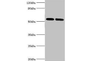 Western blot All lanes: V-type proton ATPase subunit B, kidney isoform antibody at 7 μg/mL Lane 1: Mouse kidney tissue Lane 2: 293T whole cell lysate Secondary Goat polyclonal to rabbit IgG at 1/10000 dilution Predicted band size: 57 kDa Observed band size: 57 kDa (ATP6V1B1 anticorps  (AA 1-280))