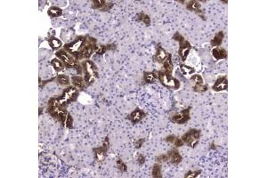 IHC testing of FFPE rat kidney tissue with CKB antibody at 1ug/ml. (CKB anticorps)