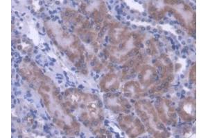 IHC-P analysis of Mouse Kidney Tissue, with DAB staining. (ACADS anticorps  (AA 210-397))