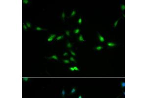 Immunofluorescence analysis of A549 cells using MDM2 Polyclonal Antibody (MDM2 anticorps)