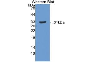 Western blot analysis of the recombinant protein. (Paxillin anticorps  (AA 327-568))