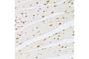 Immunohistochemistry of paraffin-embedded rat heart using MAPK3 Antibody.