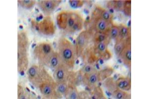 IHC-P analysis of Liver tissue, with DAB staining. (DVL1 anticorps  (AA 150-332))