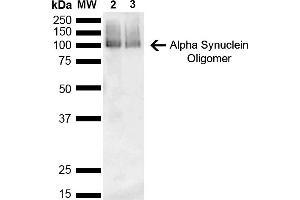 Western Blot analysis of Mouse, Rat Brain showing detection of 14 kDa Alpha Synuclein protein using Mouse Anti-Alpha Synuclein Monoclonal Antibody, Clone 3C11 (ABIN5564064). (SNCA anticorps  (Biotin))