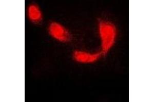 Immunofluorescent analysis of RBPJ staining in MCF7 cells.