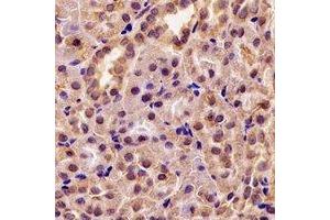 Immunohistochemical analysis of GRP75 staining in rat kidney formalin fixed paraffin embedded tissue section. (HSPA9 anticorps)