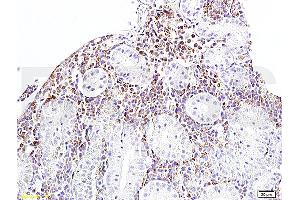 Formalin-fixed and paraffin embedded rat kidney tissue labeled withAnti-Bcl-2 Polyclonal Antibody, Unconjugated (ABIN723920) 1:400 followed by conjugation to the secondary antibody and DAB staining