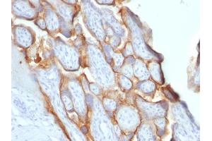 Formalin-fixed, paraffin-embedded human placenta stained with hCG beta Monoclonal Antibody (SPM529). (CGB anticorps)