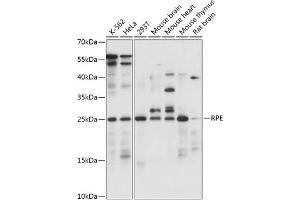 Western blot analysis of extracts of various cell lines, using RPE antibody (ABIN7270048) at 1:1000 dilution. (RPE anticorps  (AA 1-228))