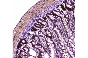 IHC analysis of BRG1 using anti-BRG1 antibody .