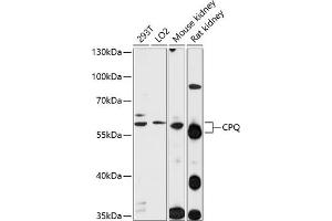 Western blot analysis of extracts of various cell lines, using CPQ antibody  at 1:1000 dilution. (CPQ anticorps  (AA 1-100))