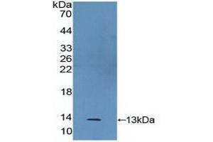Detection of Recombinant S100A2, Human using Polyclonal Antibody to S100 Calcium Binding Protein A2 (S100A2) (S100A2 anticorps  (AA 2-98))