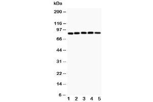 Western blot testing of IKK alpha antibody and Lane 1:  MCF-7