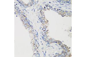 Immunohistochemistry of paraffin-embedded human prostate using GLUD1 antibody at dilution of 1:200 (40x lens).