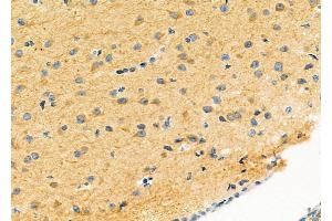 ABIN6263007 and ABIN6279522 at 1/100 staining Mouse brain tissue by IHC-P.