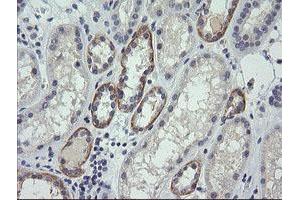 Image no. 1 for anti-Cancer/testis Antigen 1B (CTAG1B) antibody (ABIN1499893) (CTAG1B anticorps)
