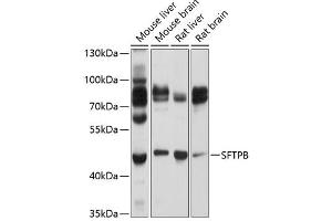 Western blot analysis of extracts of various cell lines, using SFTPB Antibody (ABIN6147687) at 1:1000 dilution. (SFTPB anticorps  (AA 94-393))