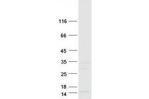 Validation with Western Blot
