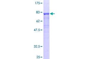 SDS-PAGE (SDS) image for Complement Factor P (CFP) (AA 1-469) protein (GST tag) (ABIN1782459)