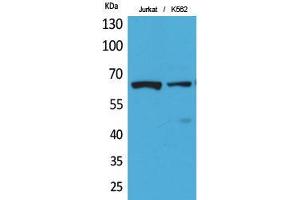 Western Blot (WB) analysis of Jurkat, K562 cells using Acetyl-NFkappaB-p65 (K218) Polyclonal Antibody.