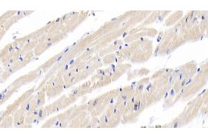 Detection of IL18 in Rabbit Cardiac Muscle Tissue using Polyclonal Antibody to Interleukin 18 (IL18) (IL-18 anticorps  (AA 32-192))