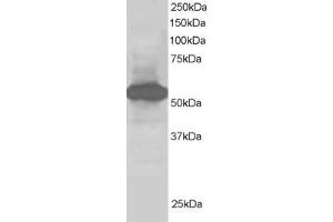ABIN185071 staining (1µg/ml) of Human Kidney lysate (RIPA buffer, 30µg total protein per lane). (SIL1 anticorps  (C-Term))